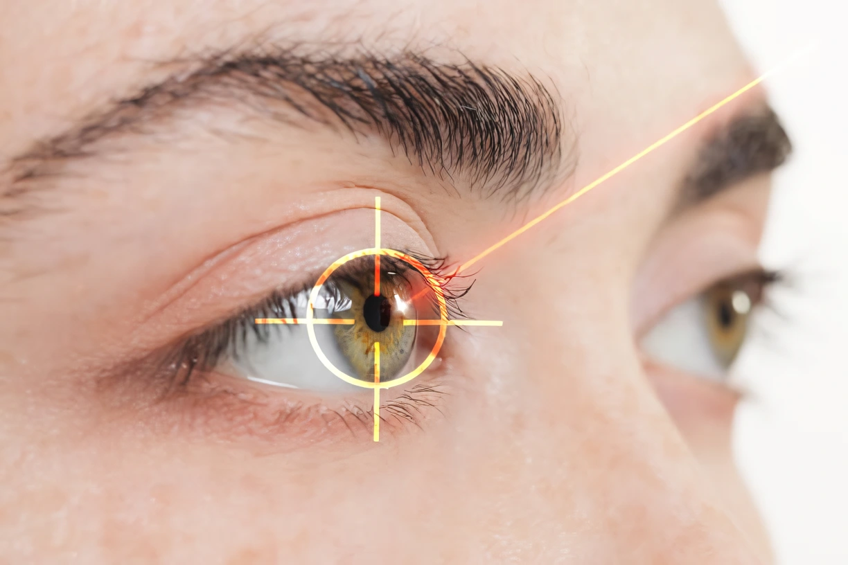 Beneficios de la cirugía laser ocular