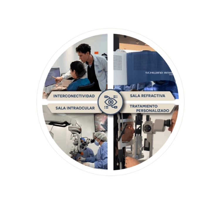 Gráfico circular dividido en cuatro secciones, mostrando distintas imágenes de procedimientos oftalmológicos con las etiquetas: 